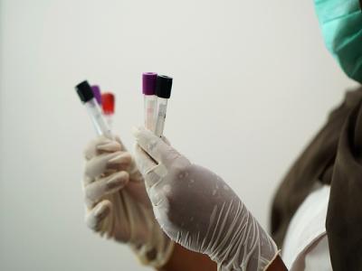 Epatiti, In Italia solo il 12% della popolazione target fa i test